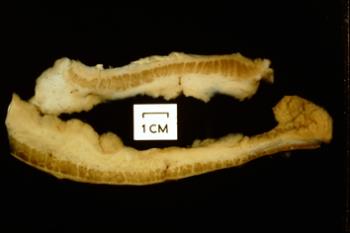 STOMACH, pylorus